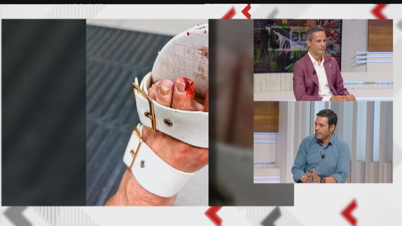 Polémica y violencia en Colmenar Viejo entre la policía local y las propietarias de un bar