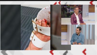 Polémica y violencia en Colmenar Viejo entre la policía local y las propietarias de un bar