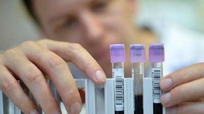 Madrid mantiene 15 casos de hepatitis infantil aguda de origen desconocido