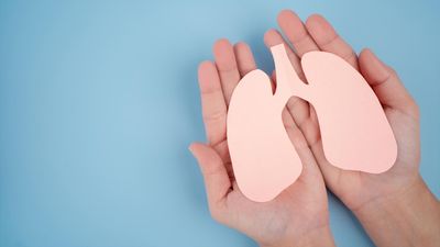 Madrid participa en un ensayo que cambia el paradigma para tratar el cáncer de pulmón en estados intermedios