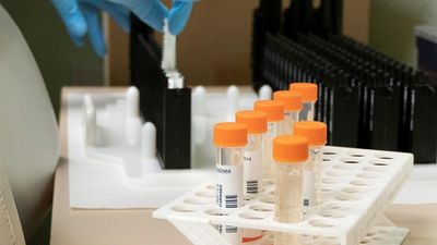 Llegan 7.110 nuevas dosis de la vacuna subcutánea contra la viruela del mono tras superarse los 5.000 casos