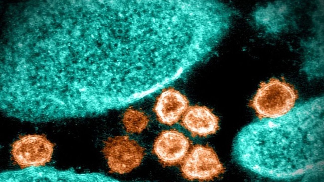 Partículas del virus SARS Cov 2 desde un microscopio