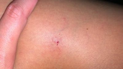 Una joven denuncia la inacción de los agentes tras un pinchazo en una discoteca: "Tuvimos que buscarnos la vida"