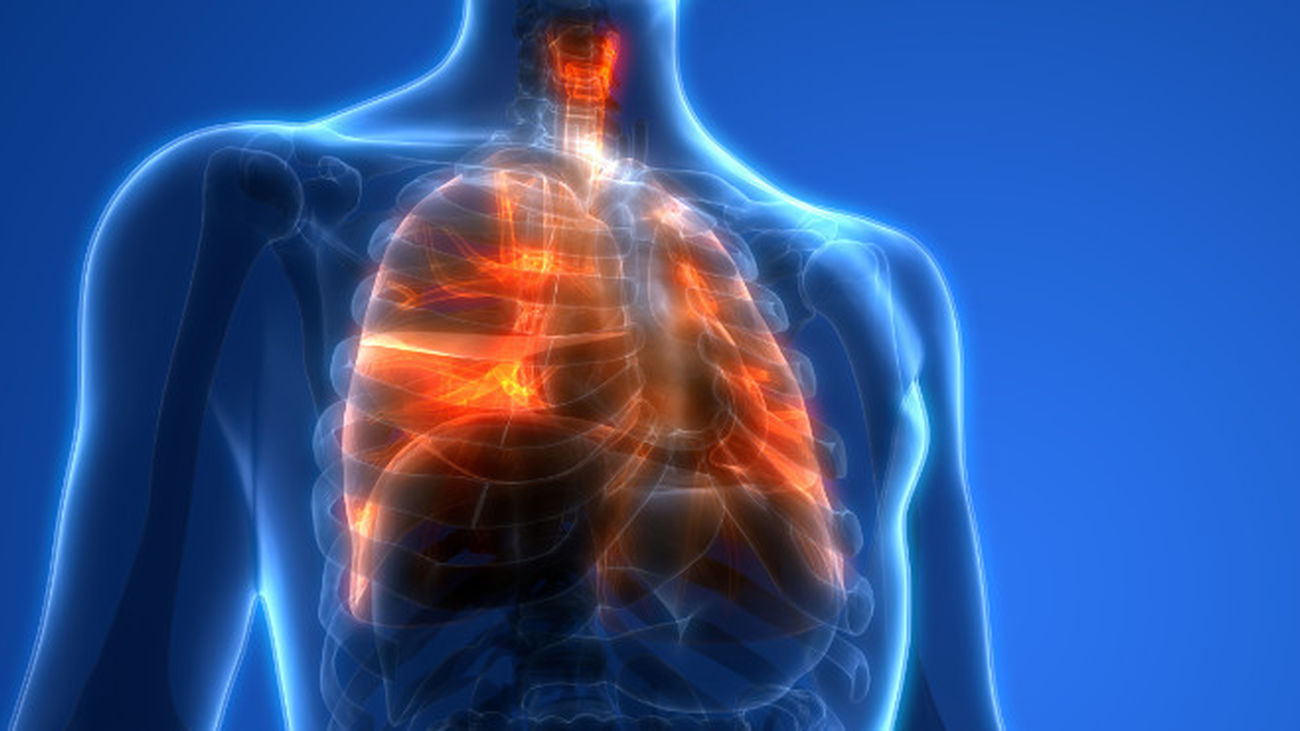 El daño pulmonar persiste un año después de sufrir neumonía por covid-19