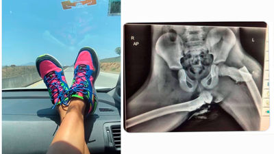 La postura en el coche que puede costar una tragedia y de la que te advierte un médico