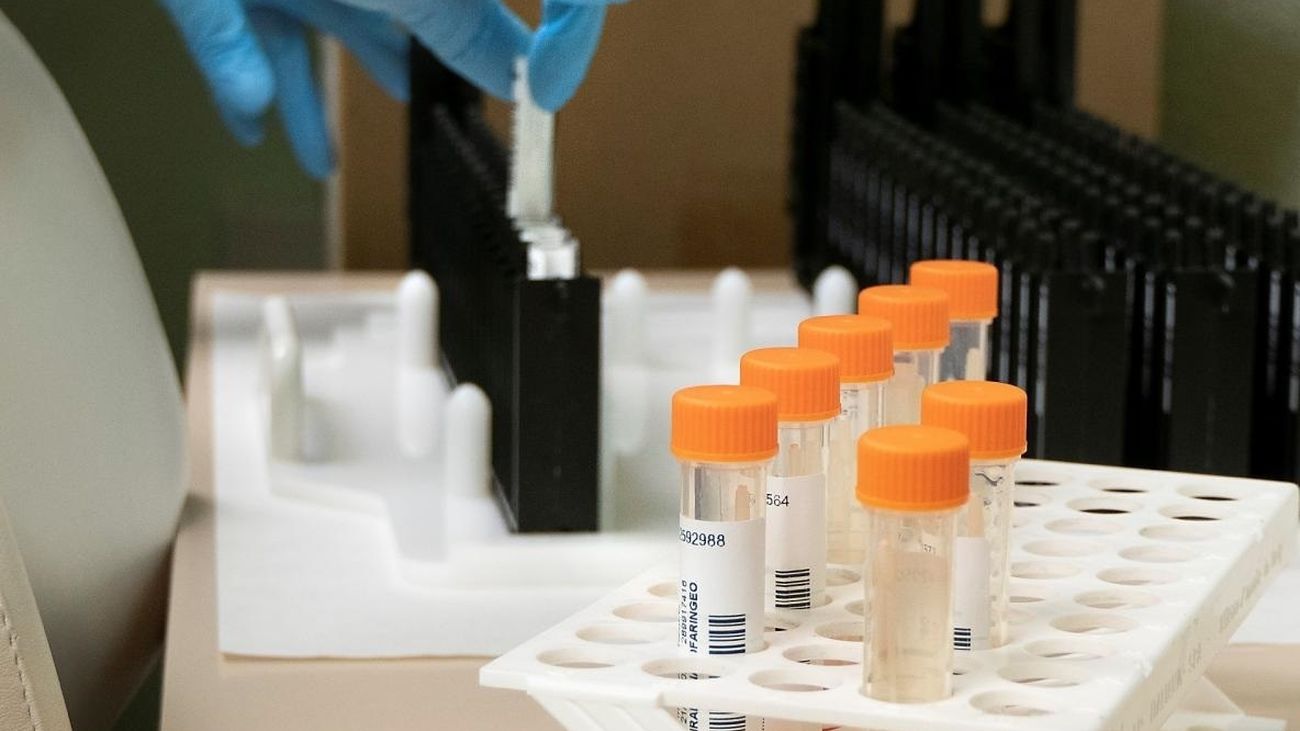 Análisis de la viruela del mono