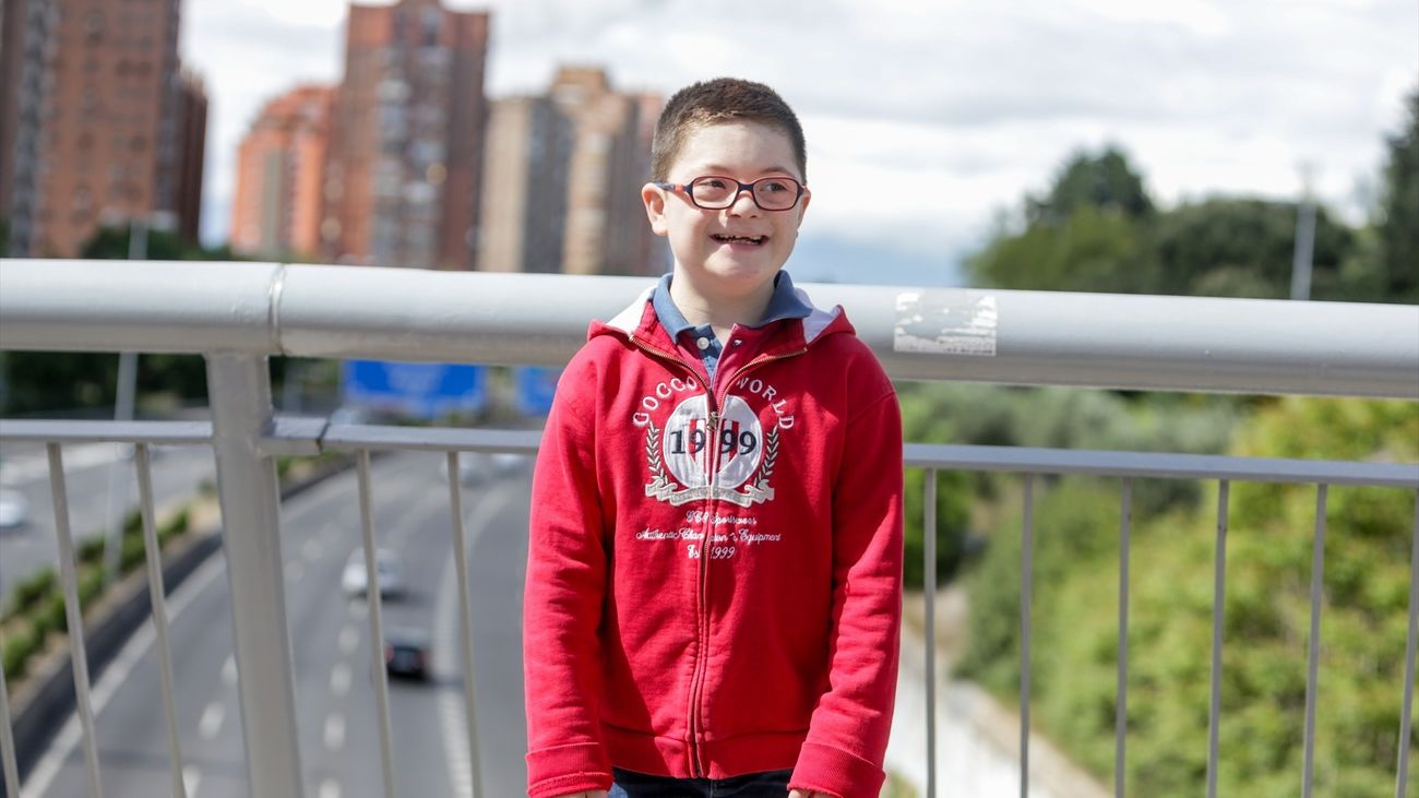 Descubren una terapia que mejora la función cognitiva en personas con síndrome de Down