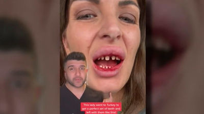 Turismo dental a Turquía, una práctica peligrosa