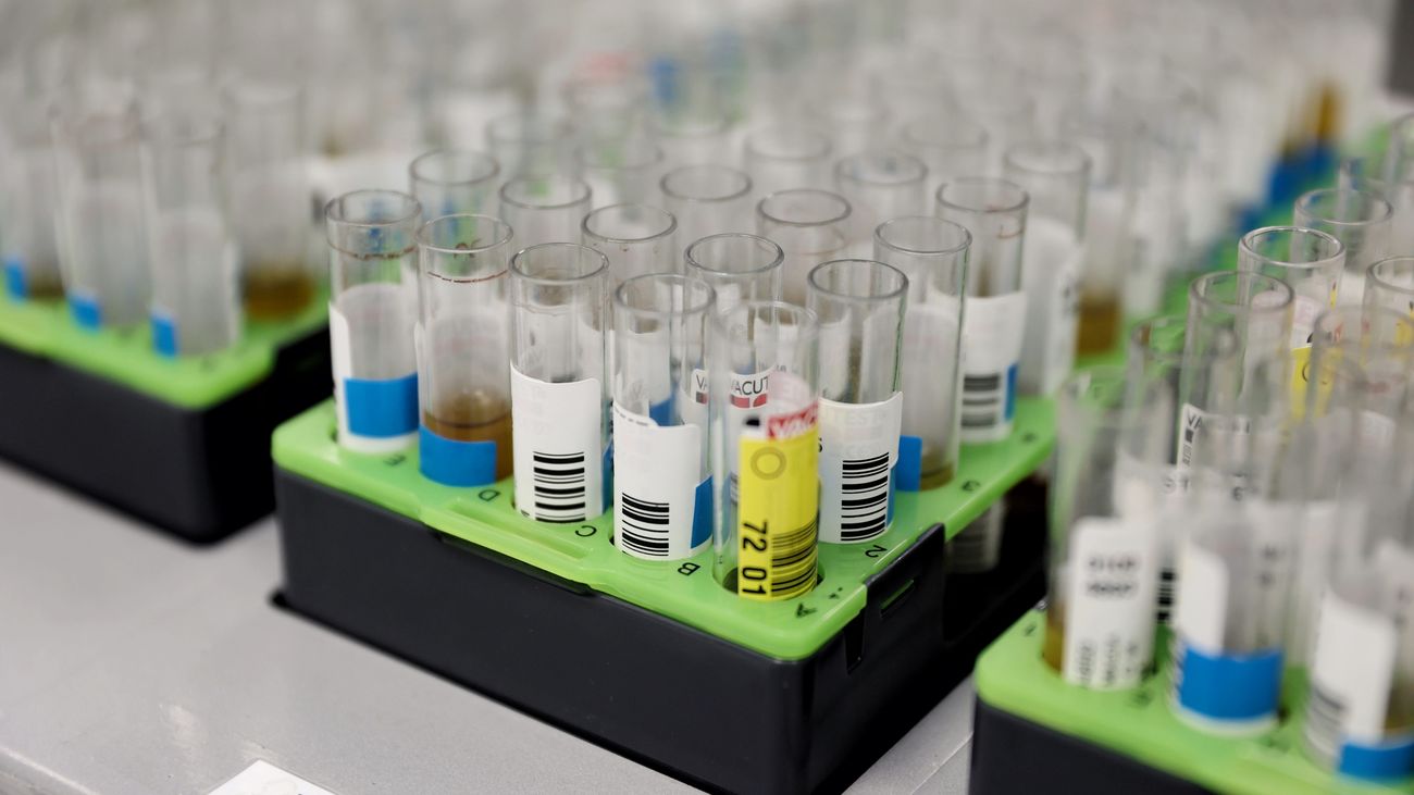 Probetas de pruebas PCR en el Laboratorio de Microbiología del Hospital Gregorio Marañón