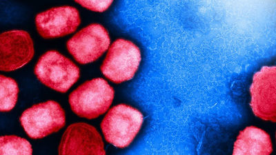 Sanidad notifica la tercera muerte por viruela del mono