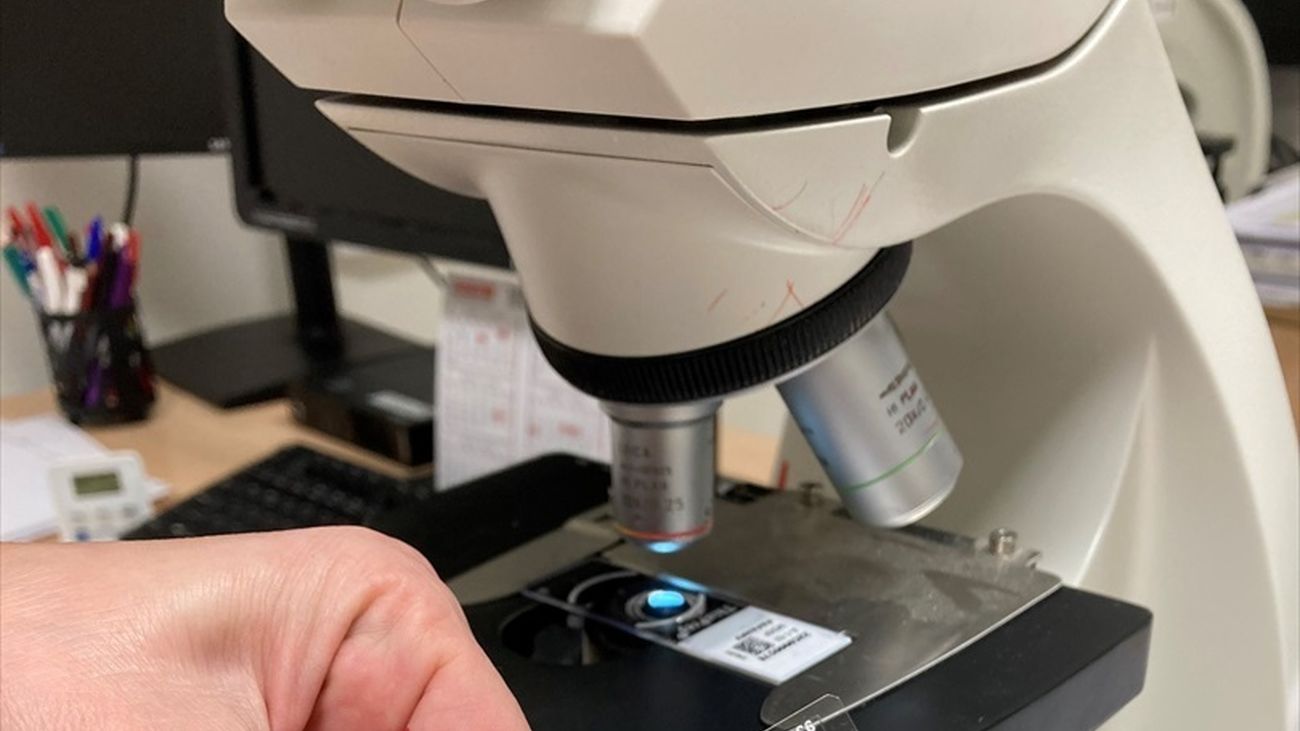 Proceso de análisis de cáncer de mama