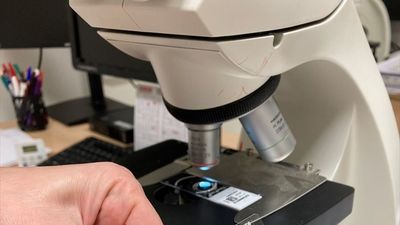 La Comisión Europea recomienda bajar a los 45 años la edad para detectar el cáncer de mama