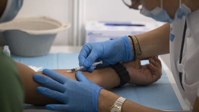 Suben a 2.472 los casos de viruela del mono en la Comunidad de Madrid