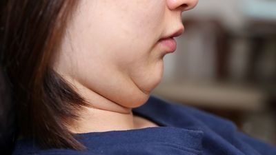 Los niños que comen rápido tienen más riesgo de sobrepeso e hipertensión