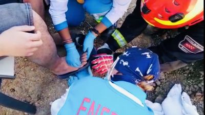 Laborioso trabajo de los Bomberos en Getafe para sacar a un hombre la púa de un rastrillo que le atravesó el pie