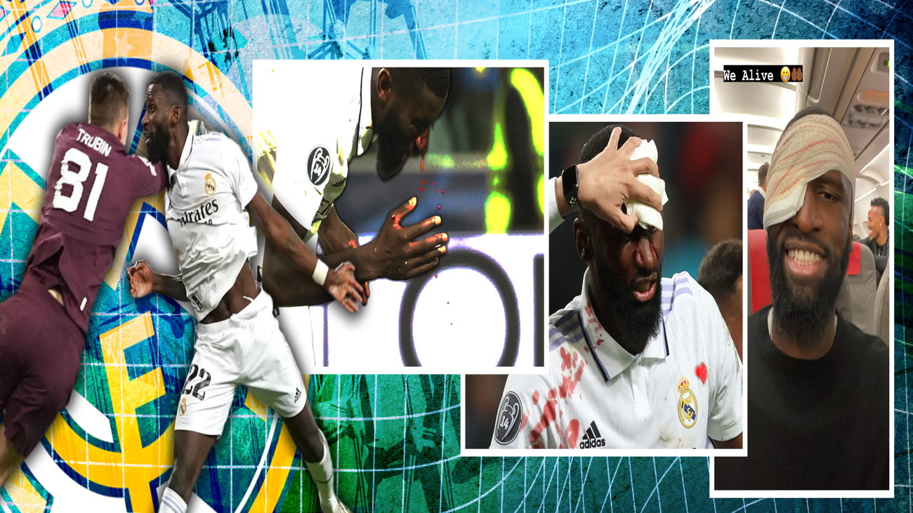 Rüdiger, tras recibir 20 puntos en la frente: “Estoy bien”