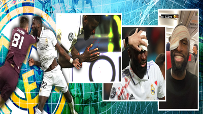 Rüdiger, tras recibir 20 puntos en la frente: “Estoy bien”