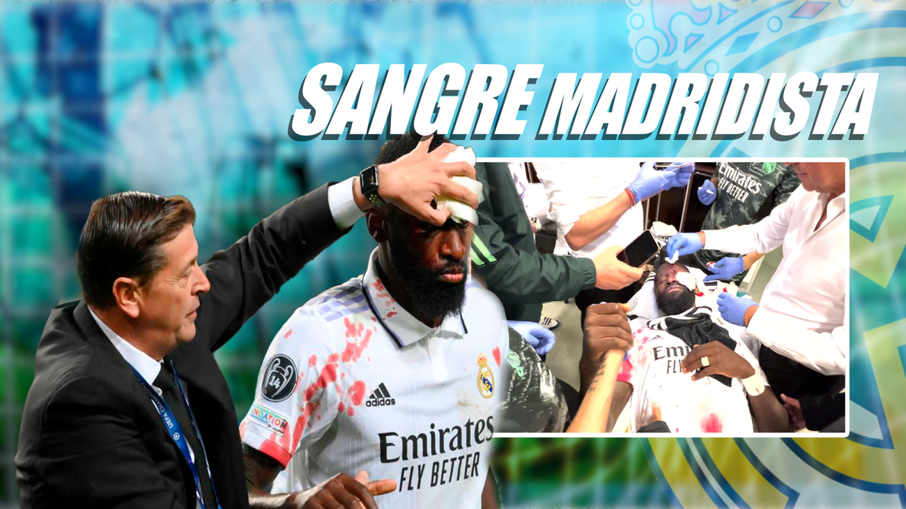 La entereza de Rudiger tras recibir 20 puntos de sutura