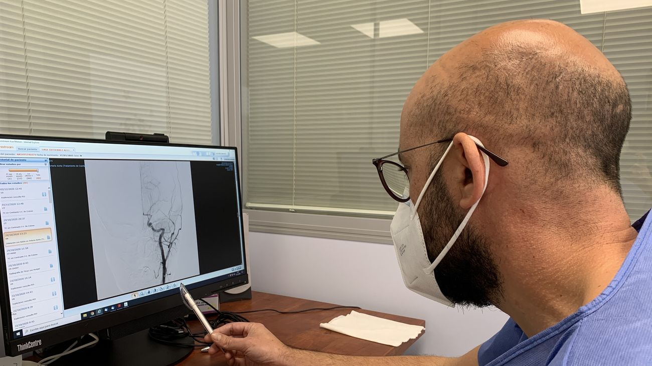 El ictus es la primera causa de muerte en mujeres y la segunda en hombres, ¿Cómo prevenirlo?