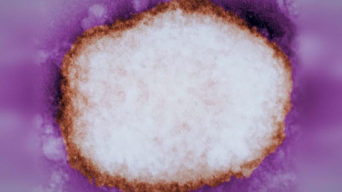 Partícula amplificada del virus de la viruela del mono.