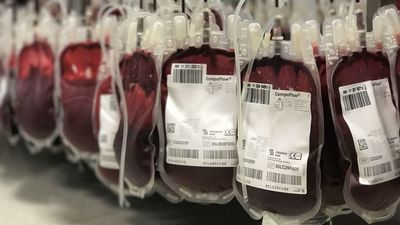 Sangre Dorada, el grupo sanguíneo que sólo tienen 50 personas en todo el mundo y puede salvar muchas vidas