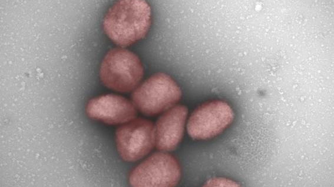 Partículas del virus de la viruela del mono teñidas de rojo