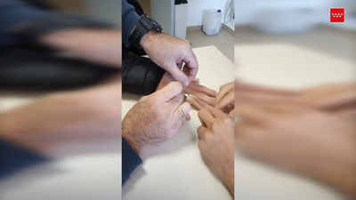 Bomberos de Arganda extraen un anillo atascado usando hilo dental