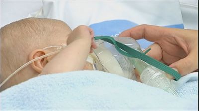 Madrid prevé llegar al pico de bronquiolitis en los próximos días