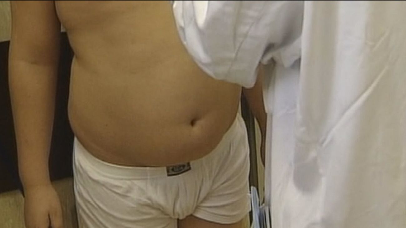 Obesidad: enfermedad y lacra en la sanidad de los países desarrollados