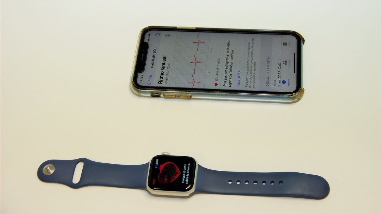 El Clínico San Carlos detecta con un smartwatch una arritmia grave en un paciente