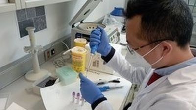 Un estudio sitúa el microbioma intestinal en el centro del origen del párkinson