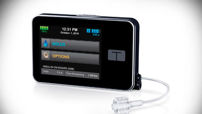 Sanidad informa de “posibles” fallos de software en las bombas de insulina t:slim X2
