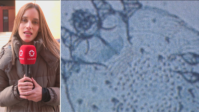 Detectados tres brotes de sarna en dos residencias de mayores y en un centro sociosanitario