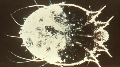 Dieciocho afectados en 4 nuevos brotes de sarna en residencias y otros centros de Madrid