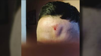 Agreden brutalmente a un joven de 22 años en Batán para robarle el móvil