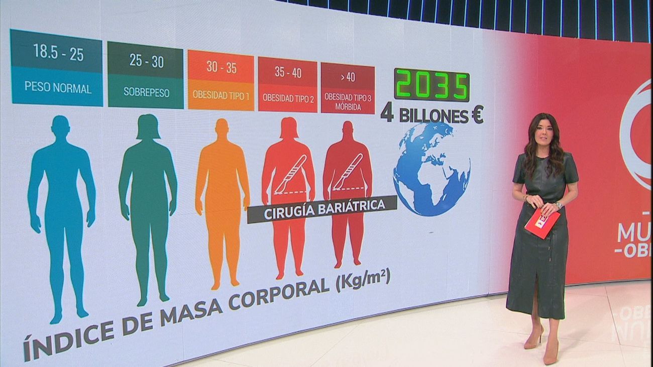 Obesidad, la gran epidemia de este siglo