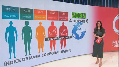 Obesidad, la gran epidemia de este siglo
