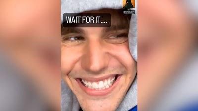 Justin Bieber recupera su sonrisa tras su parálisis  facial