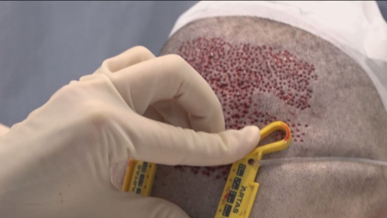 El Ministerio de Exteriores alerta del peligro de las operaciones estéticas en Turquía