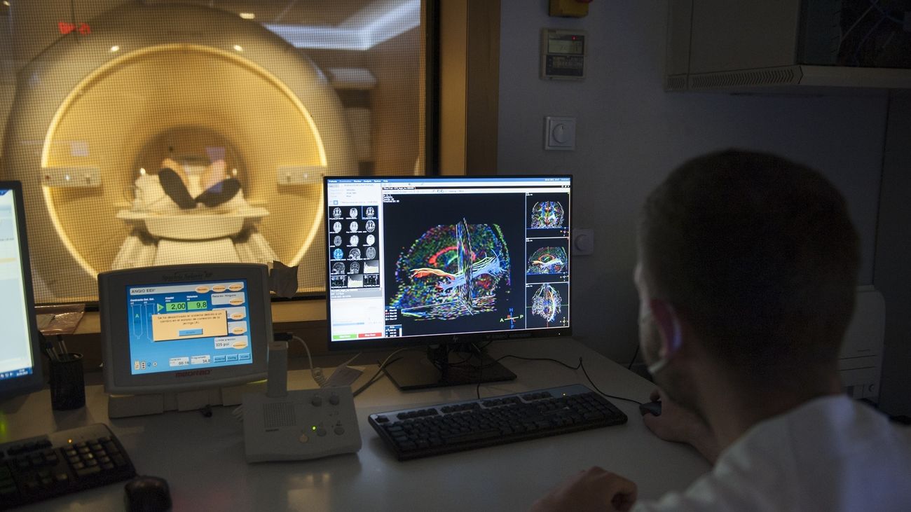Resonancia magnética para localización de tumor cerebral