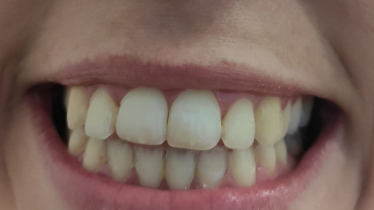 Retirados del mercado dos enjuagues bucales contaminados con una bacteria