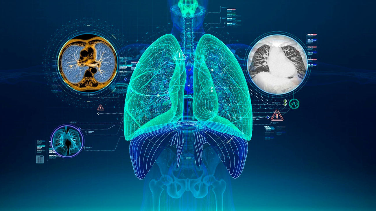 La Sociedad Europea de Radiología y GE Healthcare acuerdan colaborar en el área de la inteligencia artificial
