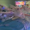 El hospital de Sanchinarro logra una doble cirugía robótica pionera en el mundo