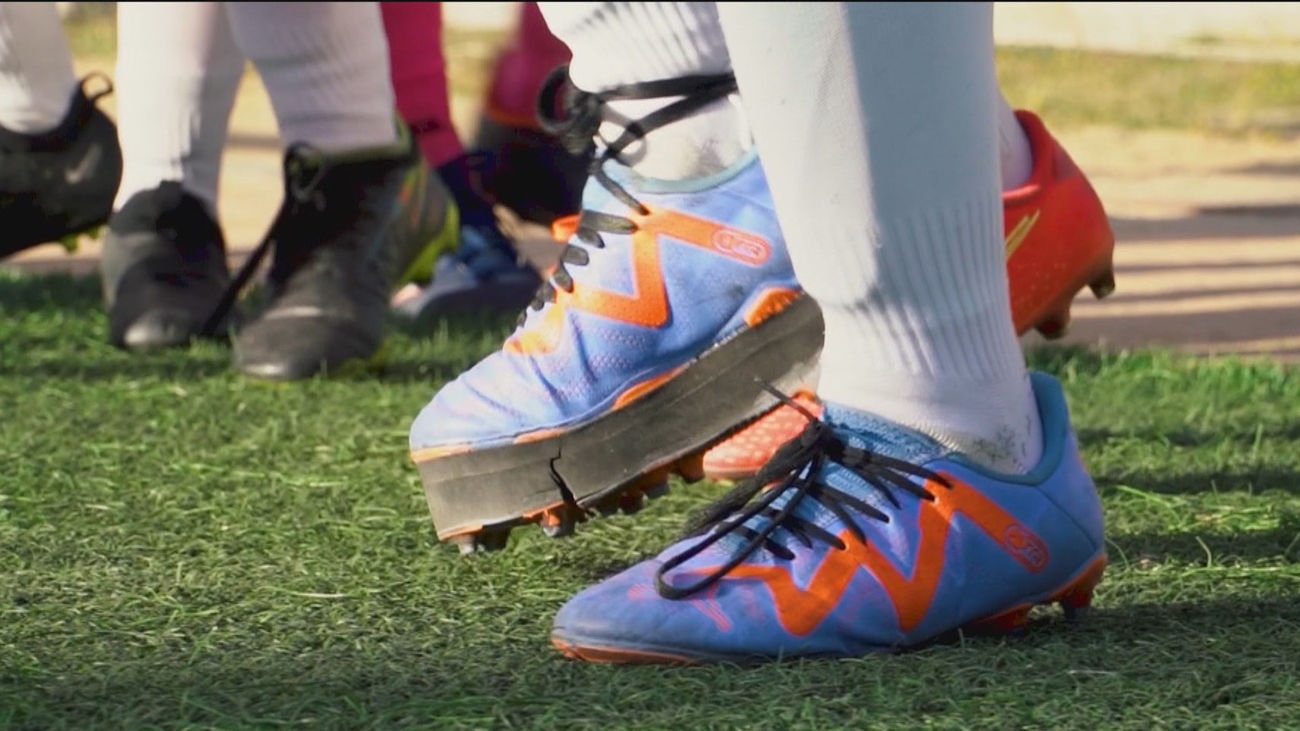 Rubén, futbolista del Orcasitas, con una pierna más corta que la otra