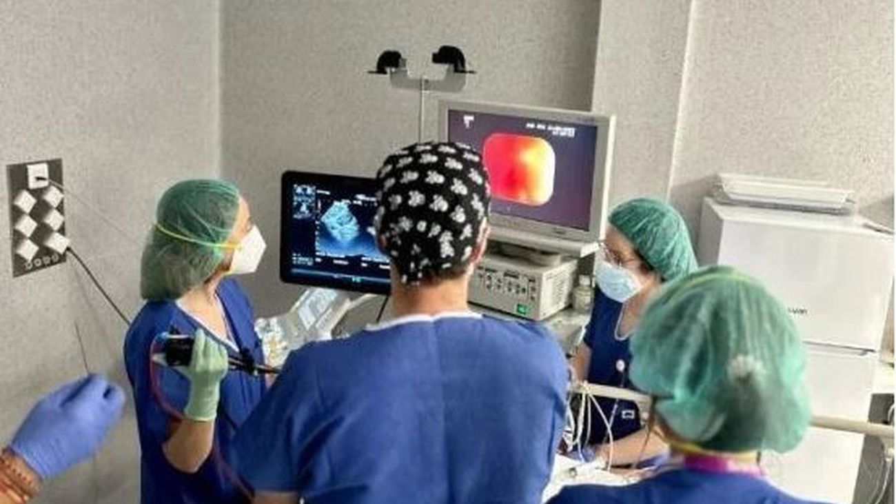 Nueva técnica para detectar el cáncer de pulmón