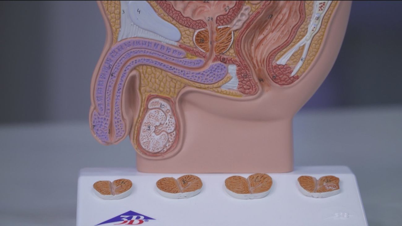 El Hospital La Paz  sensibiliza sobre el cáncer de próstata