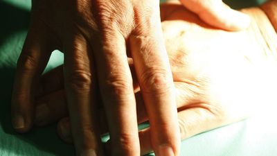 Qué hacer en caso de sufrir una quemadura