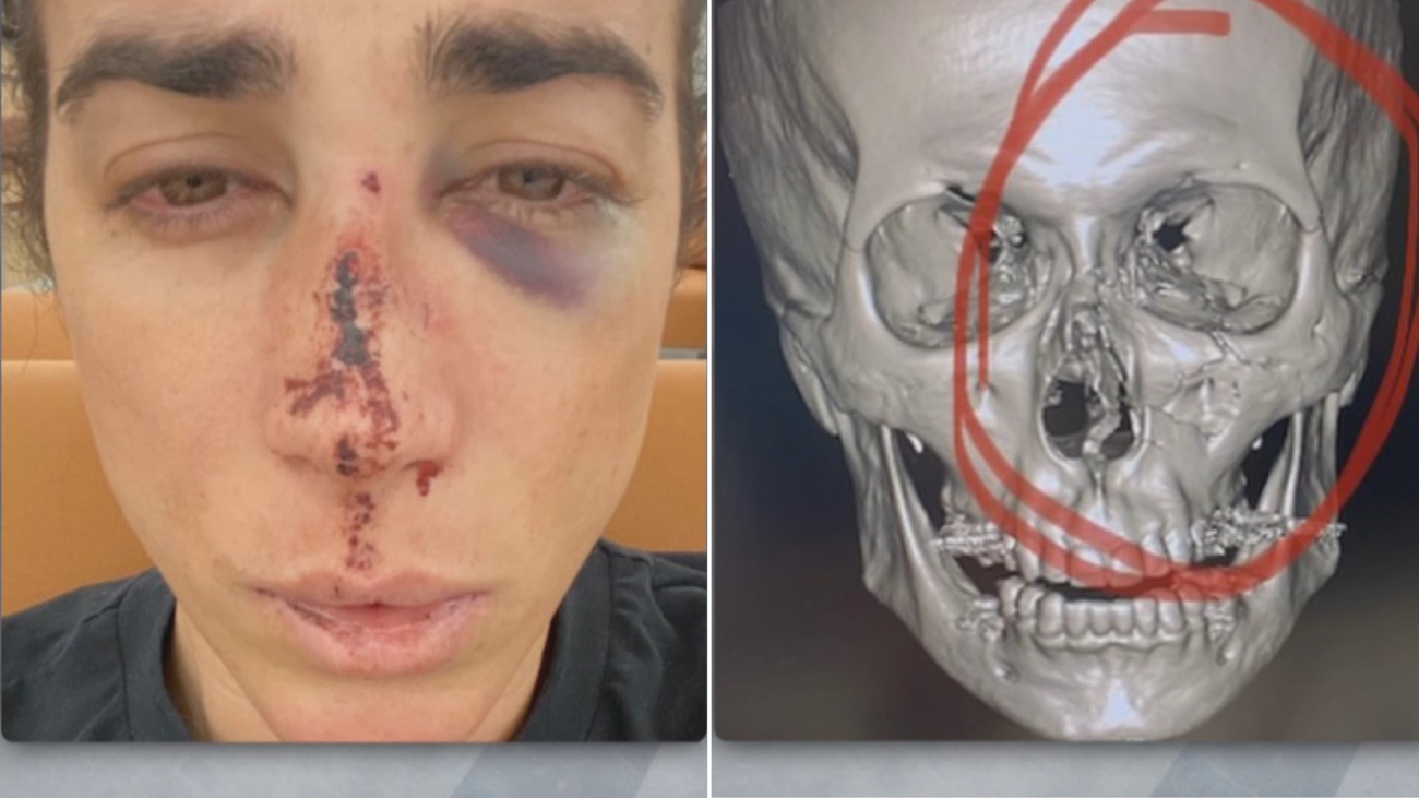 “Ha intentado matarme”; la brutal agresión homófoba a Divino que ha empañado el Orgullo