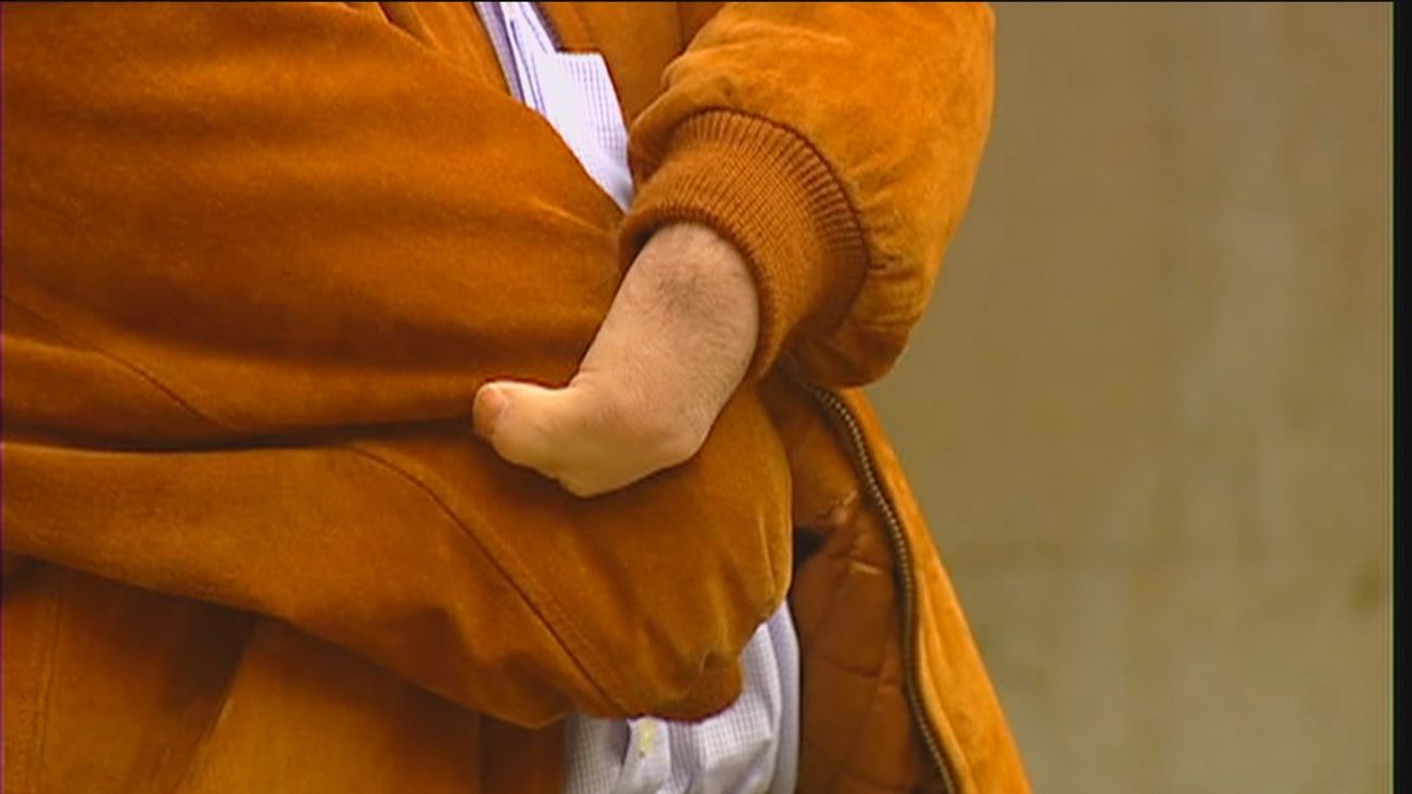 El Consejo de Ministros aprueba indemnizar a 130 víctimas de la talidomida