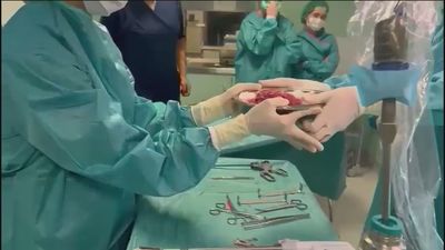 Un alarde de precisión para mejorar la vida de 3 personas